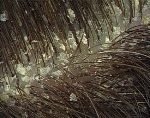 And no, it's not snow.